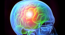 BRAIN INJURY PREVENTION